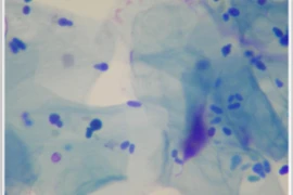 Ear-resistible Cytology: Why Every Vet nurse Should Love a Swab