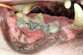 Step-by-Step - How to Perform Professional Periodontal Therapy 