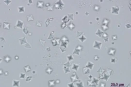 What Is That - Unravelling the Mysteries of Urine Sediment for Nurses 