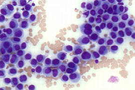 Evaluation of Cytology Samples for Nurses